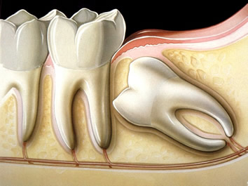 Cirurgia Odontologica